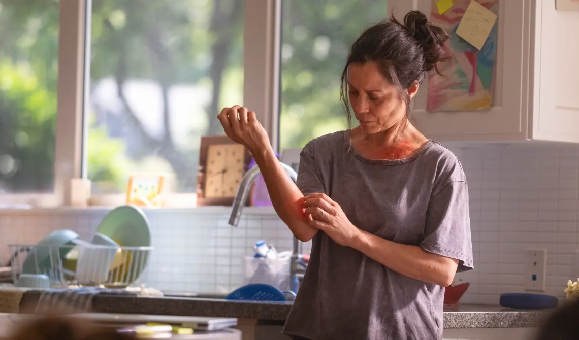 woman standing in a kitchen, scratching her arm