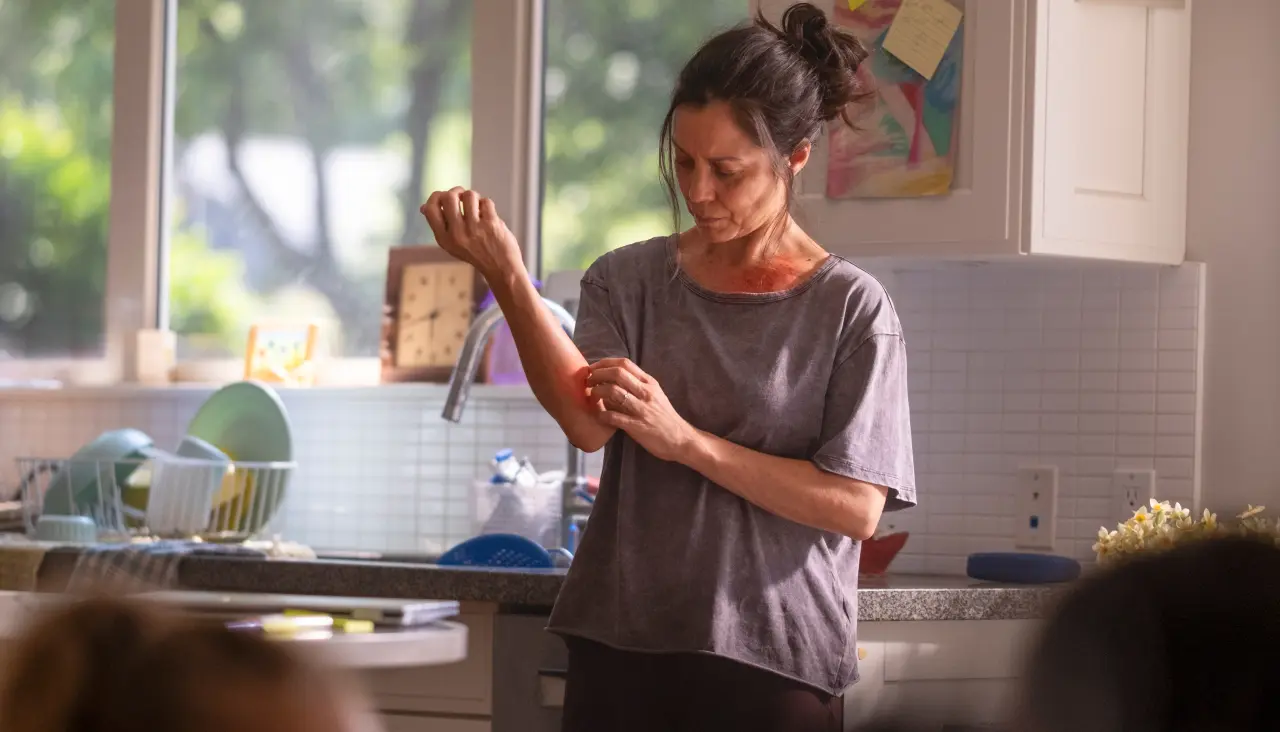 woman standing in a kitchen, scratching her arm